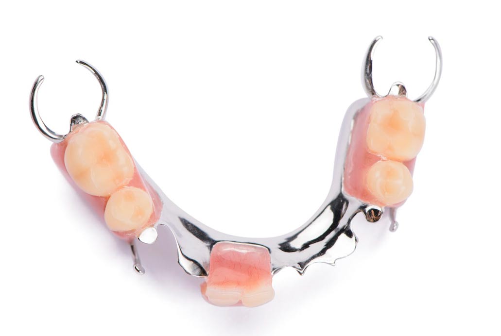 partial-dentures